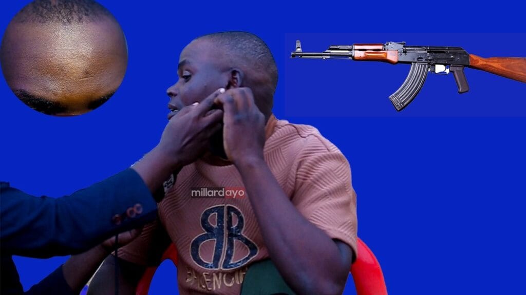 Kijana Anayeishi Na Risasi Nne Kichwani – Asimulia Mazito Ya Kushangaza